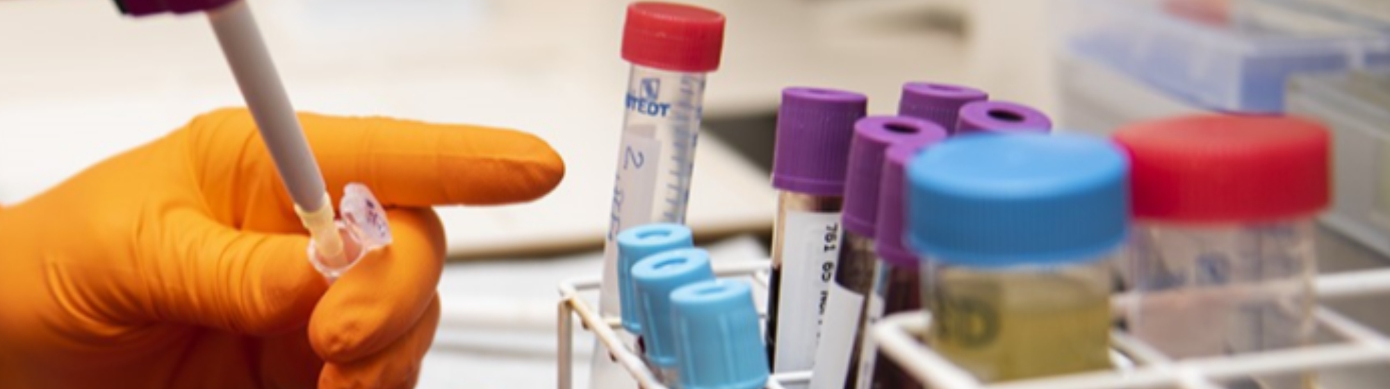 Basic and preclinical research